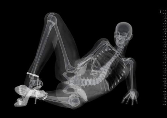 Eizo - X-Ray Pin-Up Calendar