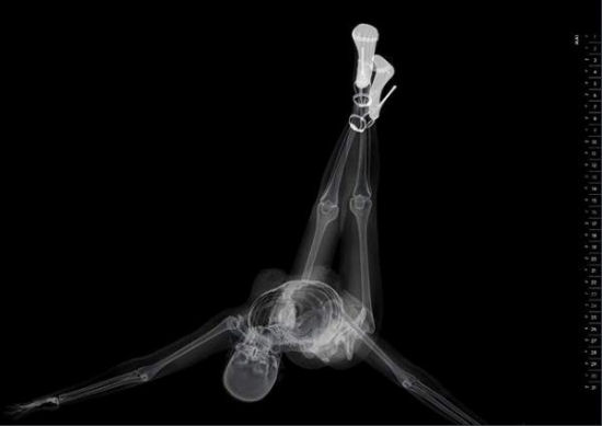 Eizo - X-Ray Pin-Up Calendar
