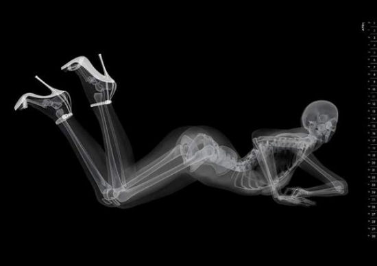 Eizo - X-Ray Pin-Up Calendar