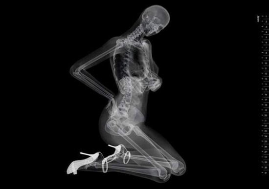 Eizo - X-Ray Pin-Up Calendar