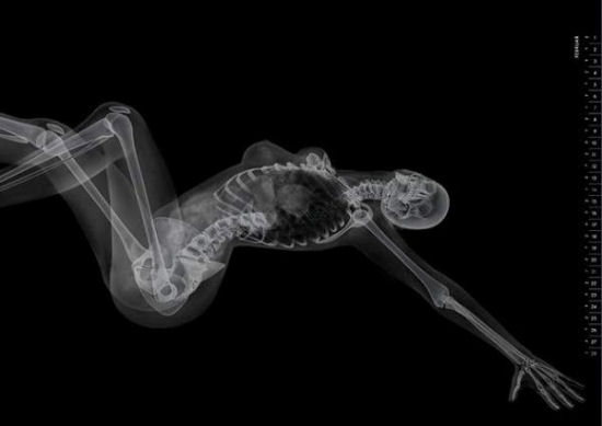 Eizo - X-Ray Pin-Up Calendar
