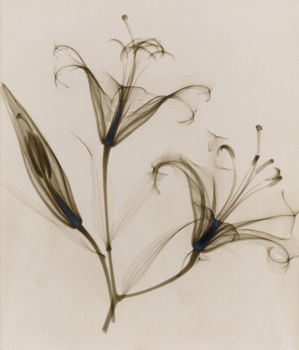 X-Ray photographs from the 1930s by Dr. Dain L. Tasker