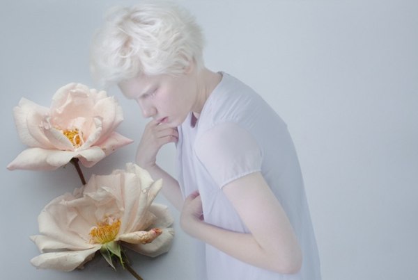 Albino, photography by Anna Danilova