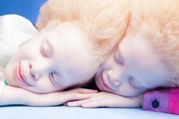 Flores Raras, albino twins from Brazil, photography by Vinicius Terranova