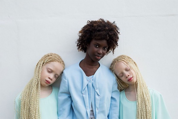 Flores Raras, albino twins from Brazil, photography by Vinicius Terranova