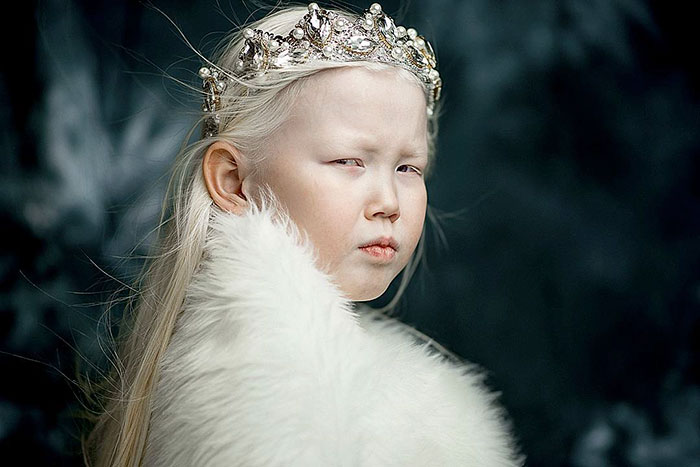 “Siberian Snow White” surprises modeling agencies with unique beauty